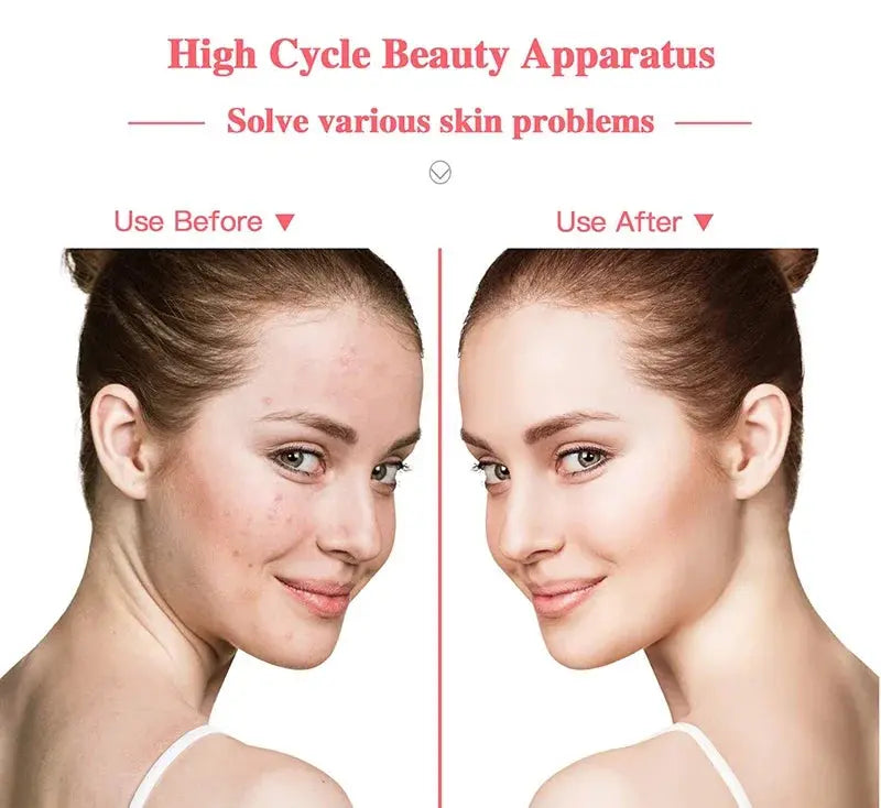 Portable High Frequency Facial Machine Wand Handheld Electric Face Skin Beauty Tools Acne Treatment Device My Store