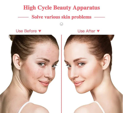 Portable High Frequency Facial Machine Wand Handheld Electric Face Skin Beauty Tools Acne Treatment Device My Store